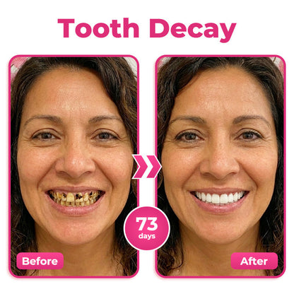 AQA™ Thismile NH-10 Enamel & Gum Advanced Therapy Toothpaste Serum
