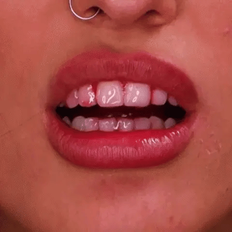 Lovqo Periodontal Care Before and After Case 2